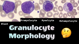 The different morphologies of Granulocytes neutrophils eosinophils and basophils [upl. by Trofmoc681]