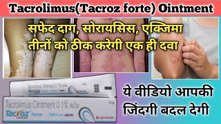 tacrolimus ointment 01 ww review  tacrolimus ointment  tacroz forte 01 ointment  tacroz forte [upl. by Threlkeld]