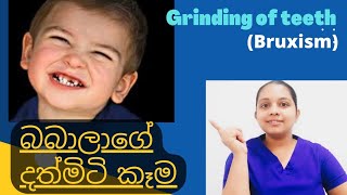 දරුවන්ගේ දත්මිටි කෑම  Teeth grinding of babies  Bruxism  Happy Family SL [upl. by Downing]