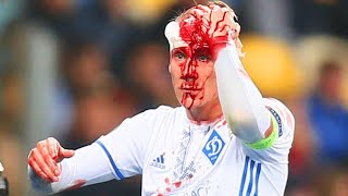 11 HORRIFIC HEAD CLASHES IN FOOTBALL [upl. by Atilemrac3]