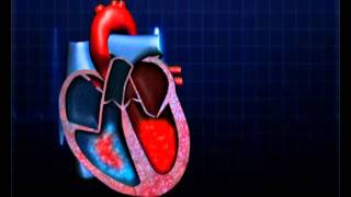 Atrial Septal Defect [upl. by Sarina174]