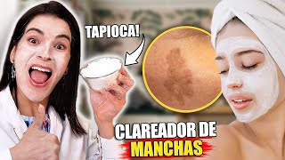 Use TAPIOCA para Clarear as Manchas de Pele [upl. by Mccready745]