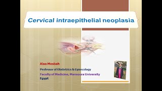 Cervical intraepithelial neoplasia [upl. by Yenahpets]