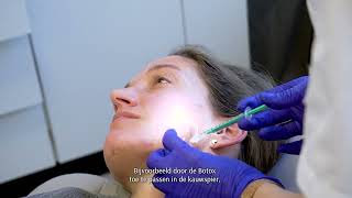 TREATMENT Confidence Booster® COLLAGEN amp Botox behandeling [upl. by Anayhd]