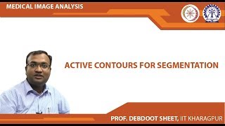 Active Contours for Segmentation [upl. by Lerrehs863]