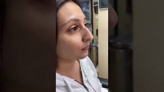 Scarless Nose™️ Rhinoplasty 1 year postop 7 day rapid recovery and can fly back to your home [upl. by Arihday650]