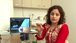 What is Colposcopy  Cervical Biopsy Results Procedure amp More [upl. by Jannelle674]