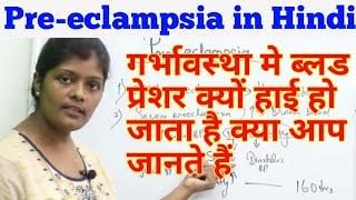 Preeclampsia lecture in hindi  प्रीएक्लेम्पसिया  Types amp causes  Hypertensionprotienureaoedema [upl. by Lumbard]