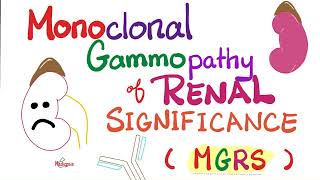 Monoclonal Gammopathy of Renal Significance MGRS  Plasma Cell Disorder  Hematology  Oncology [upl. by Eniawd]