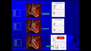 cardiac afterload [upl. by Richy]