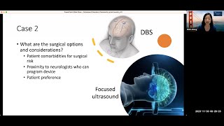 Surgical Treatment Options for Movement Disorders  UCSF Neurosurgery Community Grand Rounds [upl. by Ahsets]