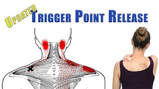 TRIGGER POINT RELEASE Upper Trapezius Levator Scapulae and Suboccipitals  UPDATED with back view [upl. by Judy]