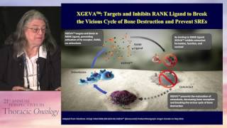 Bone metastases Role of zoledronic acid denosumab and other strategies [upl. by Moira]