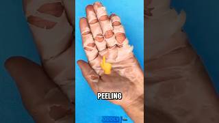 Why Your Skin Peels Like This trending feedshorts education [upl. by Animsay940]