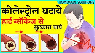 कोलेस्ट्रॉल को ख़त्म करें और हार्ट ब्लॉकेज से छुटकारा पाएं  Remove cholesterol amp Cleanse Arteries [upl. by Cherlyn853]