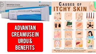 Advantan cream use in urdu amp benefits and side effects [upl. by Ednarb]