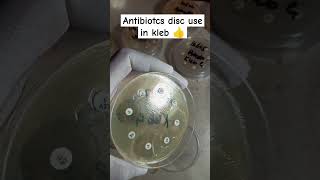 Klebsiella pneumoniae antibiotics sensitivity Disc  Kleb antibiotics disc  culture sensitivity [upl. by Roley]