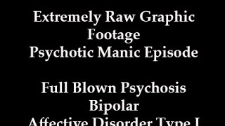 Extreme Graphic Psychosis Mania Bipolar Disorder Full Blown Manic Episode Raw Footage [upl. by Ruffina26]