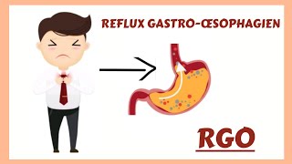 Le Reflux Gastroœsophagien RGO physiopathologie diagnostic traitement [upl. by Lesde396]