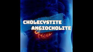 Cholecystite et Angiocholite [upl. by Natsirhc]