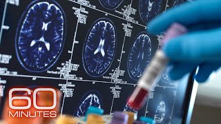 Alzheimers and Dementia  60 Minutes Full Episodes [upl. by Rida567]