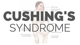 What is Cushing Syndrome  pathology symptoms causes diagnosis treatment [upl. by Nocaed874]