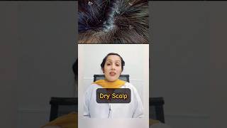 Dry Scalp Causes Remediesand Best Treatments for Healthy Hair reducehairfall antihairfall [upl. by Aneer]