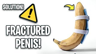 quotThe Shocking Truth About Penis Fractures What Every Man Should Knowquot [upl. by Aicenek]