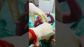 Vernix cleaning newbornbaby baby cute beautiful newborn trending babygirl cutebaby [upl. by Kimberli]