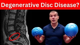 4 MustDo Exercises For Degenerative Discs In Lower Back Dont Skip These [upl. by Aurea536]