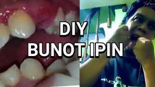 DIY BUNOT NGIPIN [upl. by Jolda695]