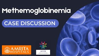 Methemoglobinemia  Case Discussion [upl. by Davidoff]