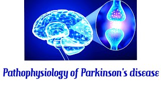 Pathophysiology Of Parkinsons Disease  Robbins pathophysiology  patholophysiology for doctors [upl. by Zirkle]