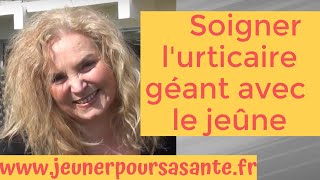 Comment Olga soigne son urticaire Géant avec le jeûne thérapeutique [upl. by Leunamesoj]