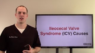 Ileocecal Valve Syndrome Causes [upl. by Efal]