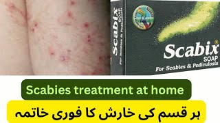 Scabix soap uses in Urdu scabies treatment at home scabix soap  pediculosis [upl. by Ly33]