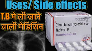 Combutol Tablet  Ethambutol Hydrochloride Tablet  TB ki Dawa  TB Medicine  Dose Side Effects [upl. by Cohby]