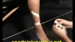 Taping technique for shin splints [upl. by Dot]