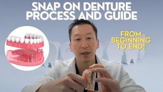 Snap on denture steps [upl. by Didi365]