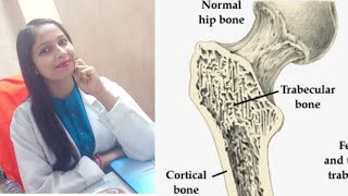 TRABECULAR SYSTEM  STRUCTURAL ADAPTATION OF BONE TO TENSILE AND COMPRESSIVE FORCE  biomechanics [upl. by Essirahs825]