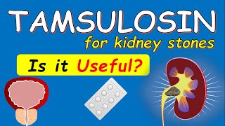 Tamsulosin for Kidney Stones  6 Things to Know [upl. by Nylhtac]