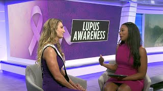 Amanda shares personal struggles on World Lupus Day [upl. by Ydarg]