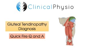 Classic Gluteal Tendinopathy Diagnosis  Clinical Physio [upl. by Hgielanna753]