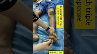 babinski with triple flexion response shorts medical aiims viral trending youtubeshorts [upl. by Anielram]