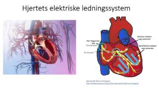 Sirkulasjonssystemet Hjertets elektriske ledningssystem [upl. by Giefer]