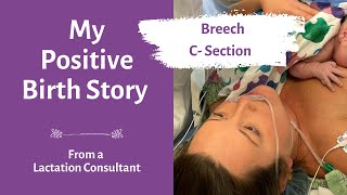 My Positive Birth Story  scheduled c section breech baby  C section recovery [upl. by Ennayhc]