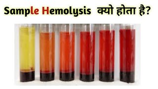 What is hemolysis  cause of hemolysis [upl. by Sabanrab]