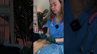 Asmr abdominal asmr satisfying asmrsounds asmrvideo relaxing medical oddlysatisfying relax [upl. by Nnayrrehs]