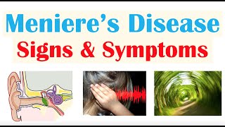 Meniere’s Disease Signs amp Symptoms amp Why They Occur [upl. by Putnem807]