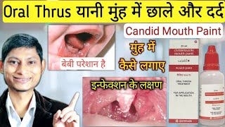 Clotrimazole mouth paint  How to apply  Candid mouth paint  Nuforce mouth paint [upl. by Neersin620]